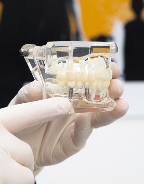 implantologia dentale firenze