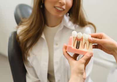 Recensioni impianti dentali